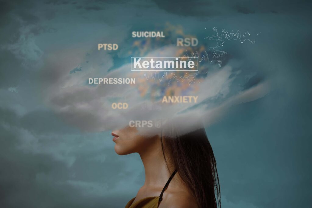 The Science Behind Ketamine Therapy for Depression and Anxiety